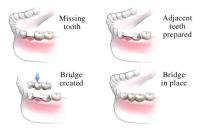 Richmond Family Dental image 4